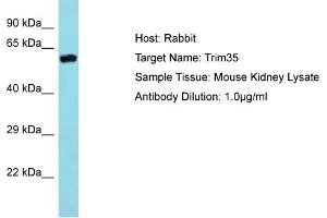 Host: Rabbit Target Name: Trim35 Sample Type: Mouse Kidney lysates Antibody Dilution: 1. (TRIM35 抗体  (Middle Region))