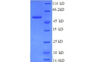SDS-PAGE (SDS) image for Ubiquitin Specific Peptidase 14 (USP14) (AA 1-494), (full length) protein (His tag) (ABIN5710602)