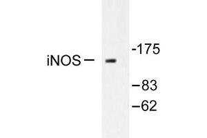 Image no. 1 for anti-Nitric Oxide Synthase 2, Inducible (NOS2) antibody (ABIN265479) (NOS2 抗体)