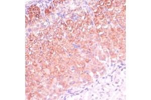 Immunohistochemistry of paraffin-embedded mouse adrenal gland using CYP11B2 antibody (ABIN1679468, ABIN3015492, ABIN3015493 and ABIN6218533) at dilution of 1:100 (40x lens). (CYP11B2 抗体  (AA 234-503))