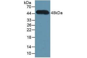 Detection of Recombinant CFH, Human using Polyclonal Antibody to Complement Factor H (CFH) (Complement Factor H 抗体  (AA 860-1231))