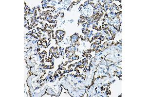 Immunohistochemistry of paraffin-embedded rat lung using  Rabbit pAb (ABIN3016739, ABIN3016740, ABIN3016741, ABIN1678526 and ABIN6219830) at dilution of 1:100 (40x lens). (Angiotensin I Converting Enzyme 1 抗体  (AA 30-270))