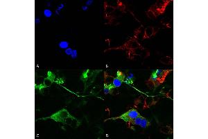 Immunocytochemistry (ICC) image for anti-gamma-aminobutyric Acid (GABA) A Receptor, alpha 1 (GABRA1) (AA 350-385) antibody (PE) (ABIN2485733)