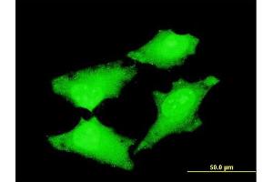 Immunofluorescence of monoclonal antibody to CDC45L on HeLa cell. (CDC45 抗体  (AA 1-566))