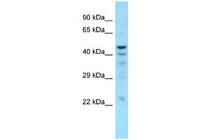 WB Suggested Anti-NT5C Antibody Titration: 1. (NT5C 抗体  (C-Term))