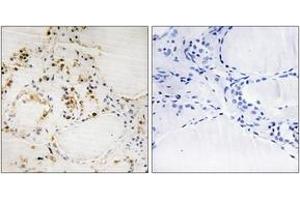 Immunohistochemistry (IHC) image for anti-B-Cell CLL/lymphoma 2 (BCL2) (AA 61-110), (pSer87) antibody (ABIN1531302)