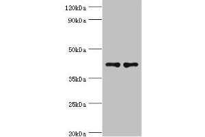 Western blot All lanes: CD33 antibody at 8 μg/mL Lane 1: K562 whole cell lysate Lane 2: HepG2 whole cell lysate Secondary Goat polyclonal to rabbit IgG at 1/10000 dilution Predicted band size: 40, 34, 26 kDa Observed band size: 40 kDa (CD33 抗体  (AA 49-259))