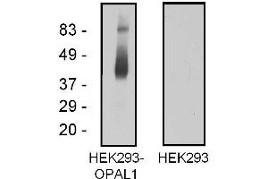 Western blotting analysis of OPAL1 in OPAL1-transfected HEK293 cells using mouse monoclonal antibody OPAL1-01. (OPAL1 抗体  (AA 152-342))