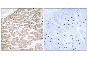 Immunohistochemistry analysis of paraffin-embedded human heart tissue using RAD antibody. (RRAD 抗体  (Internal Region))