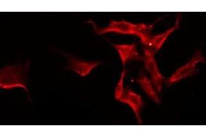 ABIN6275588 staining Hela by IF/ICC. (SLC24A3 抗体  (Internal Region))