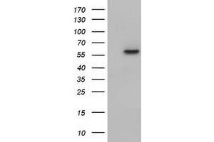 HEK293T cells were transfected with the pCMV6-ENTRY control (Left lane) or pCMV6-ENTRY KLHL2 (Right lane) cDNA for 48 hrs and lysed. (KLHL2 抗体  (AA 1-100, AA 494-593))