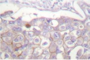 Image no. 1 for anti-Claudin 4 (CLDN4) antibody (ABIN265363) (Claudin 4 抗体)