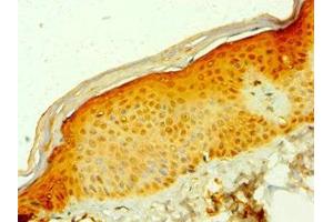 Immunohistochemistry of paraffin-embedded human skin tissue using ABIN7158940 at dilution of 1:100 (MDH1 抗体  (AA 1-334))