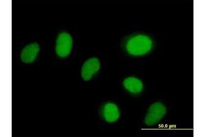 Immunofluorescence of purified MaxPab antibody to ZNF792 on HeLa cell.
