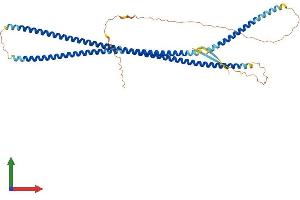 Protein Structure (PS) image for Desmin (DES) (AA 1-469) protein (His tag) (ABIN7563104)