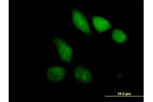 Immunofluorescence of purified MaxPab antibody to MBD1 on HeLa cell. (MBD1 抗体  (AA 1-605))