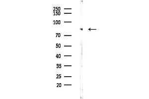 Western blot analysis of lysates from Hela cells(heat-shock,45 min treatment), using PKC zeta Antibody at 1/1000 dilution.