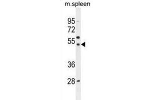 Western Blotting (WB) image for anti-Solute Carrier Family 16, Member 13 (Monocarboxylic Acid Transporter 13) (SLC16A13) antibody (ABIN2996178) (SLC16A13 抗体)