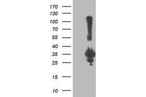 Western Blotting (WB) image for anti-Phenylethanolamine N-Methyltransferase (PNMT) antibody (ABIN1500311) (PNMT 抗体)