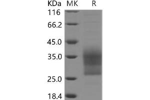 CD79b Molecule, Immunoglobulin-Associated beta (CD79B) protein (His tag)