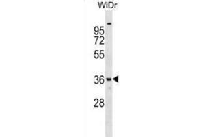 Western Blotting (WB) image for anti-Annexin A9 (ANXA9) antibody (ABIN2999180) (Annexin A9 抗体)
