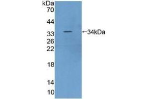 Detection of Recombinant FRAP, Human using Polyclonal Antibody to Serine/threonine-protein kinase mTOR (mTOR) (MTOR 抗体  (AA 2226-2488))