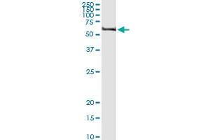 Immunoprecipitation of TRIM62 transfected lysate using anti-TRIM62 MaxPab rabbit polyclonal antibody and Protein A Magnetic Bead , and immunoblotted with TRIM62 purified MaxPab mouse polyclonal antibody (B01P) . (TRIM62 抗体  (AA 1-475))