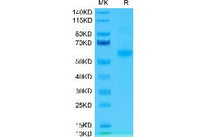 Human Siglec-15 on Tris-Bis PAGE under reduced condition. (SIGLEC15 Protein (AA 24-260) (Fc Tag))