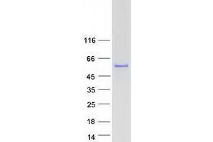 Western Blotting (WB) image for Zinc Finger, FYVE Domain Containing 27 (ZFYVE27) (Transcript Variant 1) protein (Myc-DYKDDDDK Tag) (ABIN2735874)