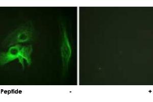 Immunofluorescence analysis of HeLa cells, using PAK1 polyclonal antibody . (PAK1 抗体)