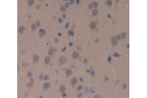 Used in DAB staining on fromalin fixed paraffin- embedded Kidney tissue (NOV 抗体  (AA 150-354))