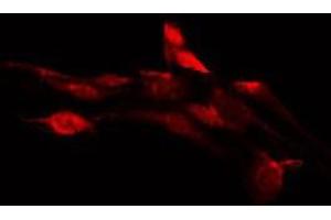 ABIN6276123 staining HepG2 by IF/ICC. (OR1D2 抗体  (Internal Region))