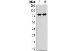 Western Blotting (WB) image for anti-Peptidyl Arginine Deiminase, Type IV (PADI4) antibody (ABIN7306048)
