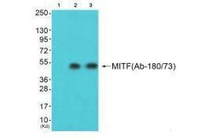 Western blot analysis of extracts from HepG2 cells (Lane 2) and 3T3 cells (Lane 3), using MITF (Ab-180/73) antiobdy.