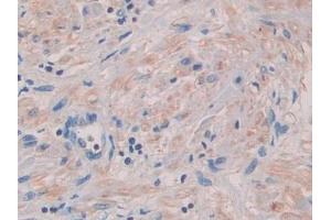 Immunohistochemistry (IHC) image for anti-Sema Domain, Immunoglobulin Domain (Ig), Short Basic Domain, Secreted, (Semaphorin) 3A (SEMA3A) (AA 580-664) antibody (ABIN7430102)