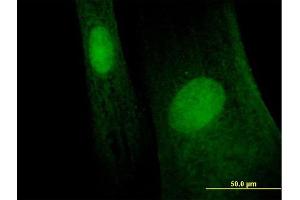 Immunofluorescence of purified MaxPab antibody to MAGEB6 on Hs 181. (MAGEB6 抗体  (AA 1-407))