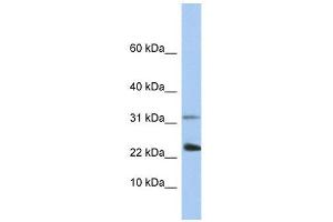 EXOSC3 antibody used at 1 ug/ml to detect target protein. (EXOSC3 抗体  (C-Term))