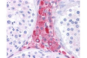 Anti-BACE1 antibody IHC of human testis. (BACE1 抗体  (N-Term))