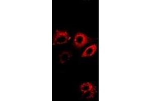 Immunofluorescent analysis of ALDH4A1 staining in A549 cells. (ALDH4A1 抗体)