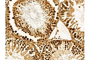 ABIN7094549 and ABIN7098598 at 1/100 staining Rat testis tissue by IHC-P.