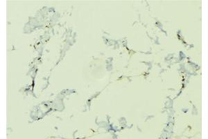 ABIN6276645 at 1/100 staining Human lung tissue by IHC-P. (NOD1 抗体  (C-Term))