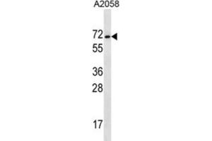 Western Blotting (WB) image for anti-Melanoma Antigen Family E, 2 (MAGEE2) antibody (ABIN2997193) (MAGEE2 抗体)