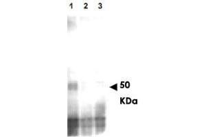 Western blot using MER2 (phospho S30) polyclonal antibody  shows detection of phos-phorylated MER2, but not phosphatase treated or mutant cells. (CD151 抗体  (pSer30))