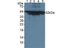 Western blot analysis of (1) Mouse Serum, (2) Mouse Intestine Tissue, (3) Mouse Pancreas Tissue, (4) Mouse Liver Tissue and (5) Human HeLa cells. (Cytokeratin 18 抗体  (AA 1-423))