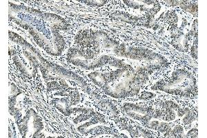 IHC analysis of ATF1 using anti-ATF1 antibody (ABIN7599192). (AFT1 抗体  (AA 1-271))