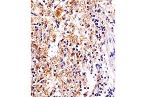 Immunohistochemical analysis of paraffin-embedded H. (FCER1G 抗体  (C-Term))