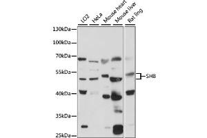 Western blot analysis of extracts of various cell lines, using SHB antibody (ABIN7270563) at 1:1000 dilution. (SHB 抗体  (AA 300-400))