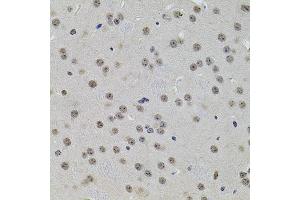 Immunohistochemistry of paraffin-embedded mouse brain using SET/T antibody (ABIN6131351, ABIN6147629, ABIN6147632 and ABIN6216153) at dilution of 1:100 (40x lens). (SET/TAF-I 抗体  (AA 146-277))