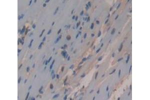 IHC-P analysis of Kidney tissue, with DAB staining. (HNRNPA1 抗体  (AA 2-320))