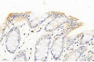 Immunohistochemistry (Paraffin-embedded Sections) (IHC (p)) image for anti-NAD Dependent Malate Dehydrogenase (NAD-ME) antibody (ABIN7074757)